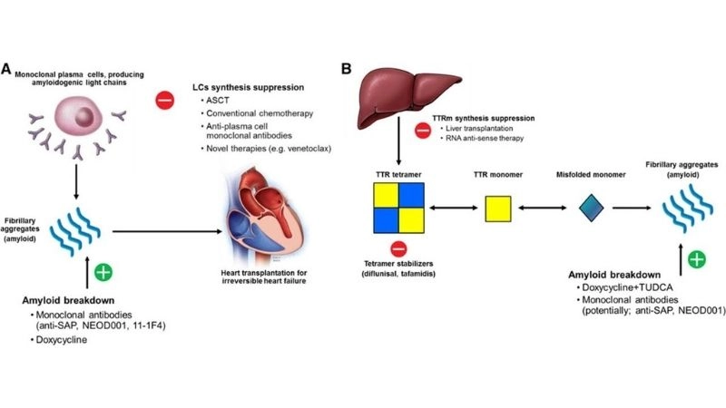 Restrictive cardiomyopathy vs hypertrophic cardiomyopathy key differences