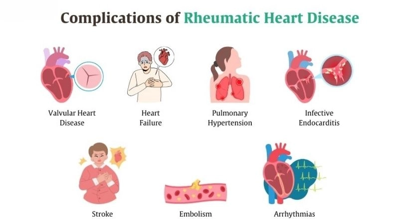 Rheumatic heart disease causes from repeated inflammation