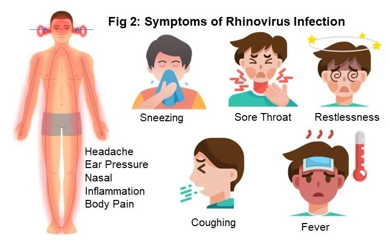 Diagram explaining what is rhinovirus