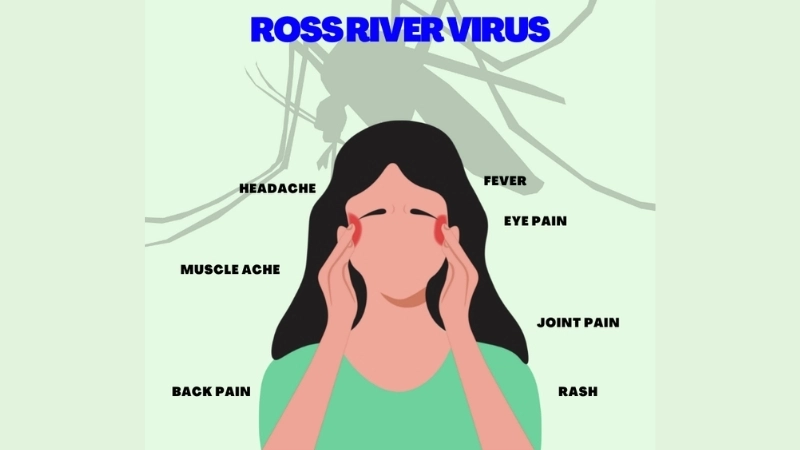 An infographic explaining what is Ross River fever