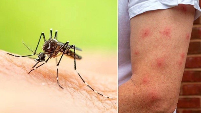 A chart comparing Ross River vs Barmah Forest virus