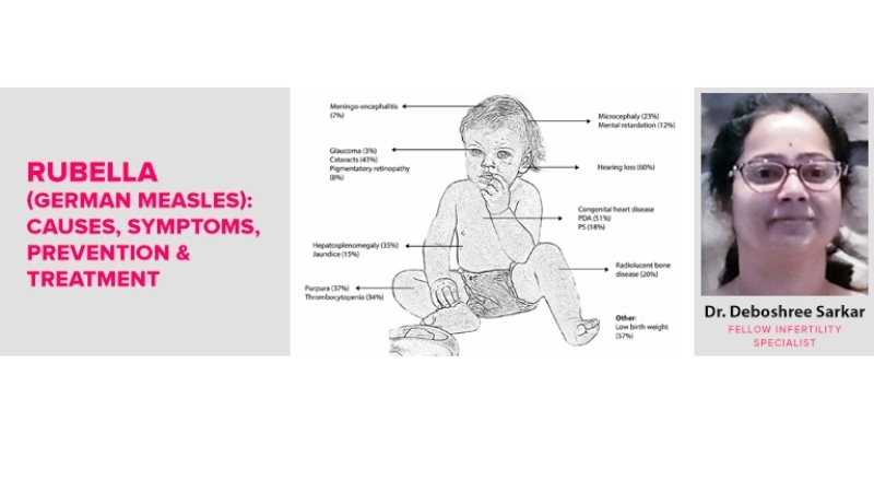 Congenital rubella syndrome from Rubella