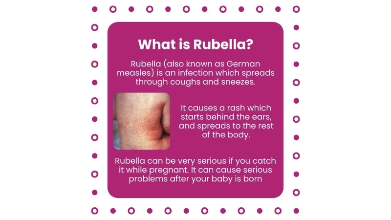 Rubella vs measles both viral