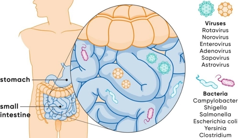 Sapovirus Infection and Sapovirus prevention tips