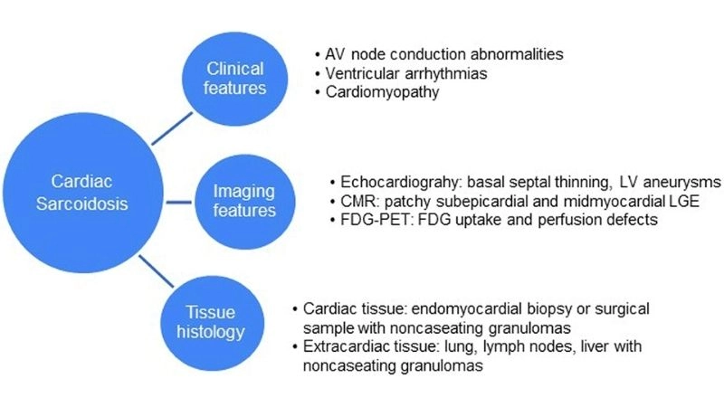 Sarcoid heart disease prognosis outlook for affected patients