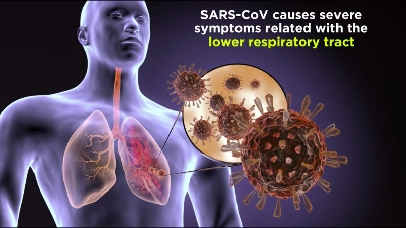 Learn key SARS symptoms for early detection