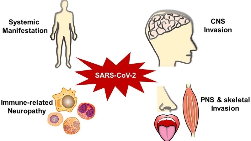 Understand SARS causes to stay well informed