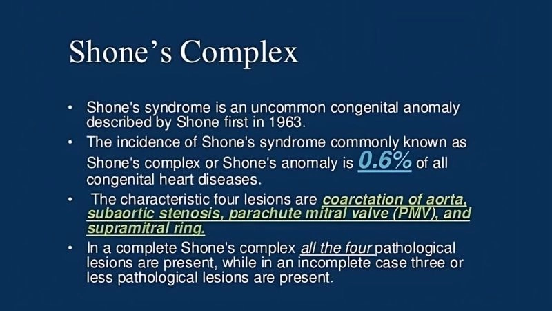 Parachute mitral valve a unique congenital valve anomaly