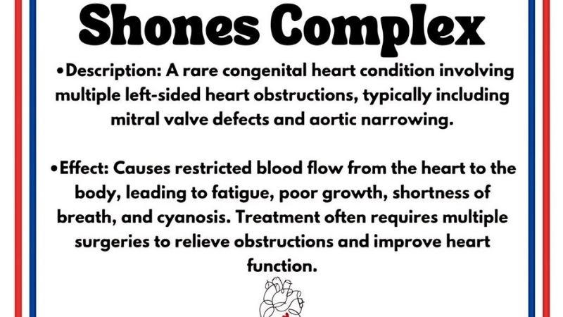 Shone's Complex in adults rare congenital issue in adulthood