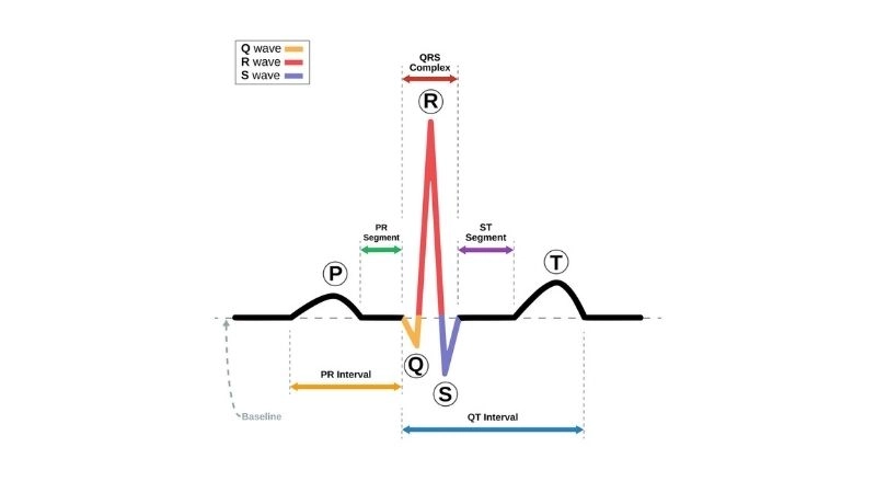 Short QT Syndrome Genetics reveal inherited condition
