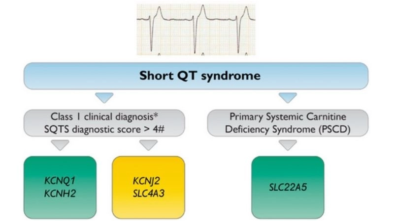 Short QT Syndrome In Children signals early danger