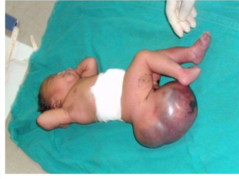 A bottle of folic acid supplements