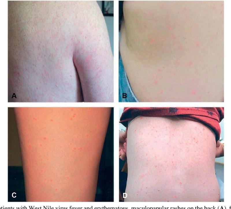 The cycle of SLEV transmission from mosquito to human