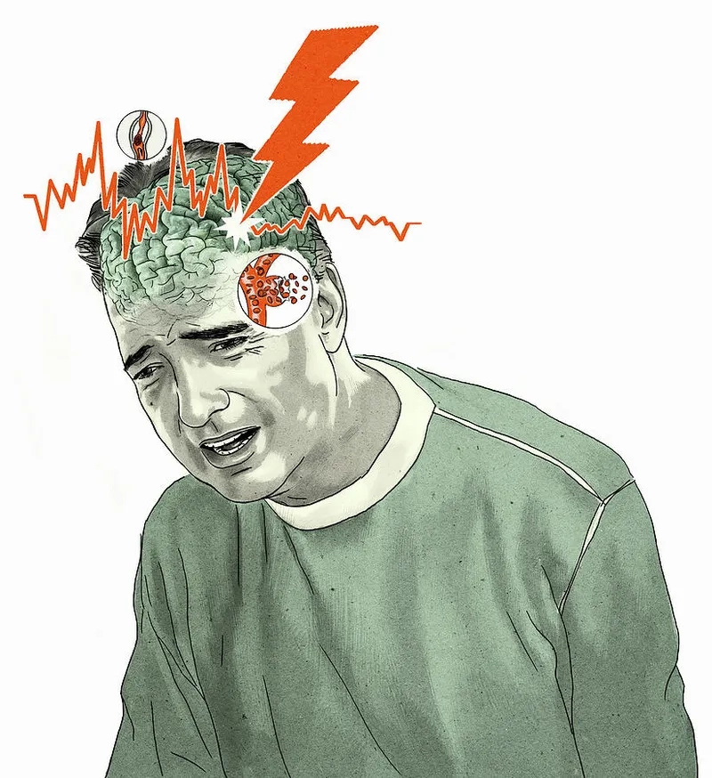 Primary causes and risk factors of stroke