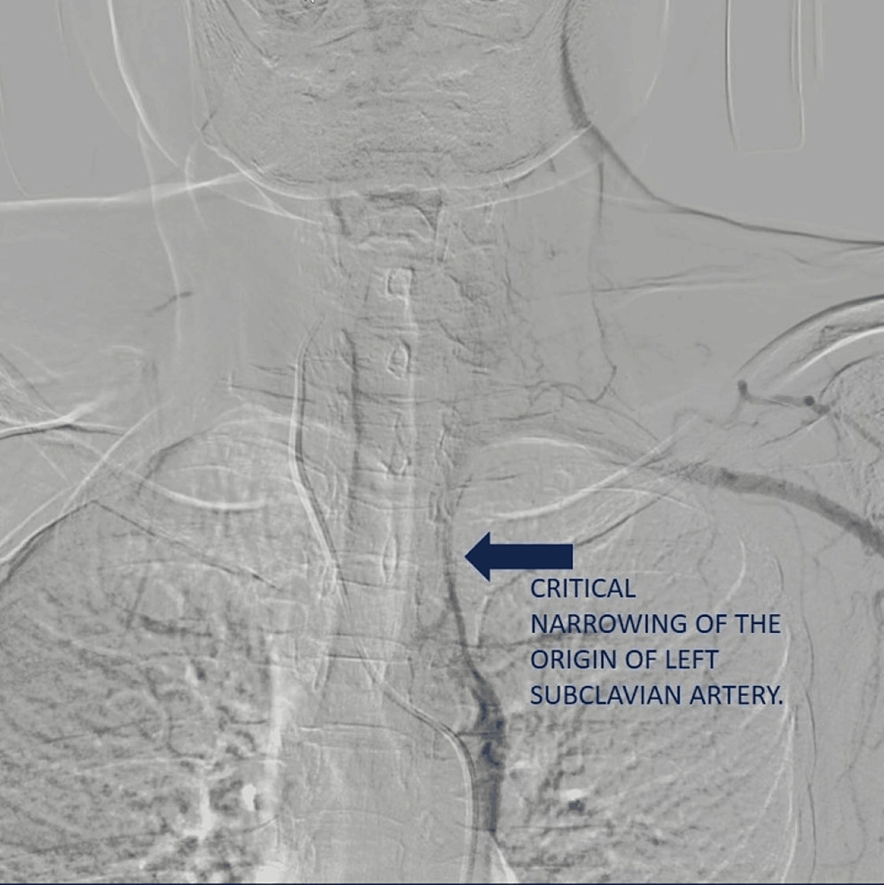 Visual showing the impact of heart disease