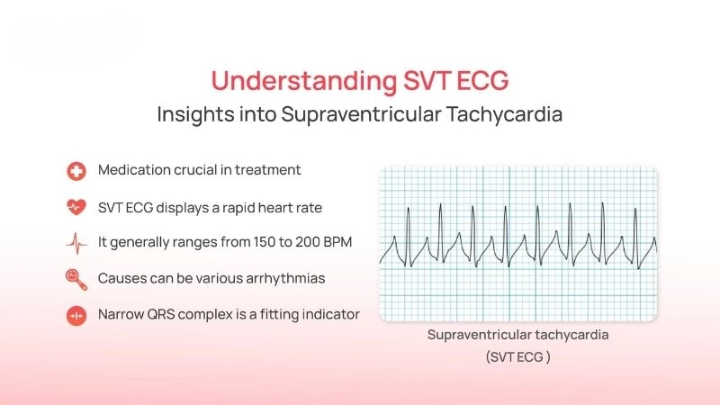 SVT and anxiety often worsen palpitations and chest discomfort