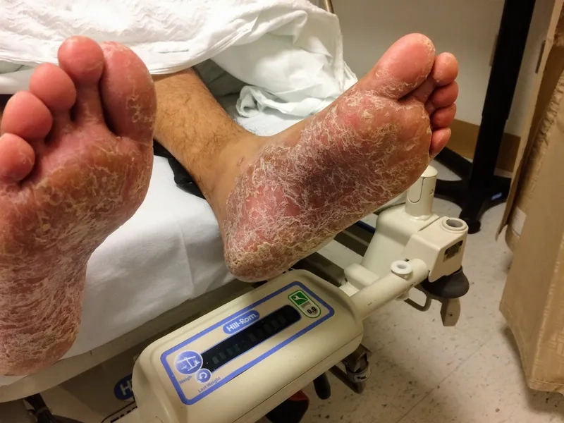 A lab technician processing a syphilis test sample