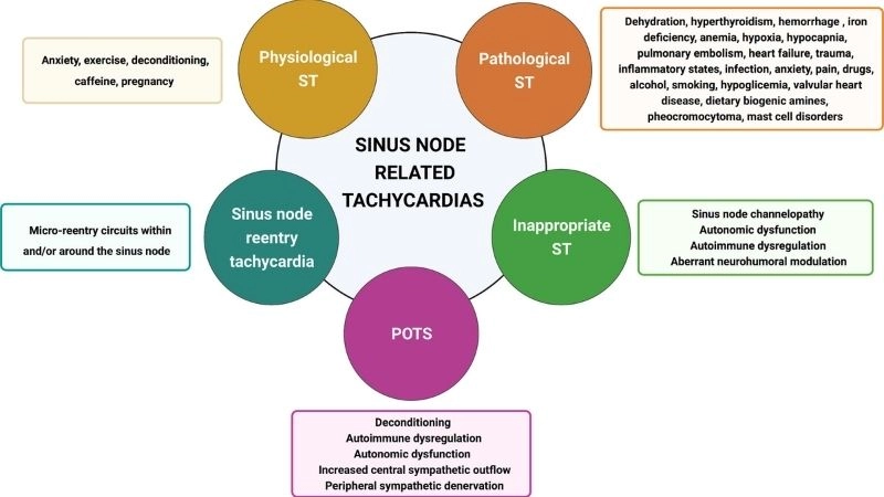 Atrial fibrillation causes irregular and rapid heartbeats