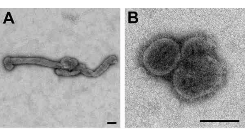 Tahyna Virus Infection and Tahyna virus history