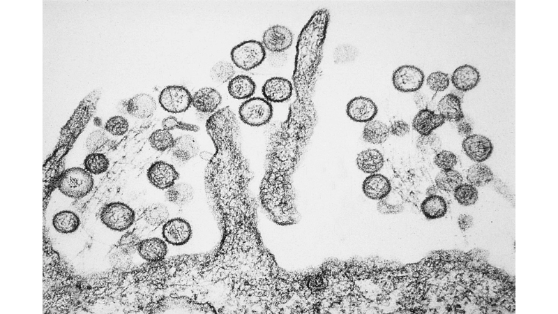 Tahyna Virus Infection via Tahyna virus transmission