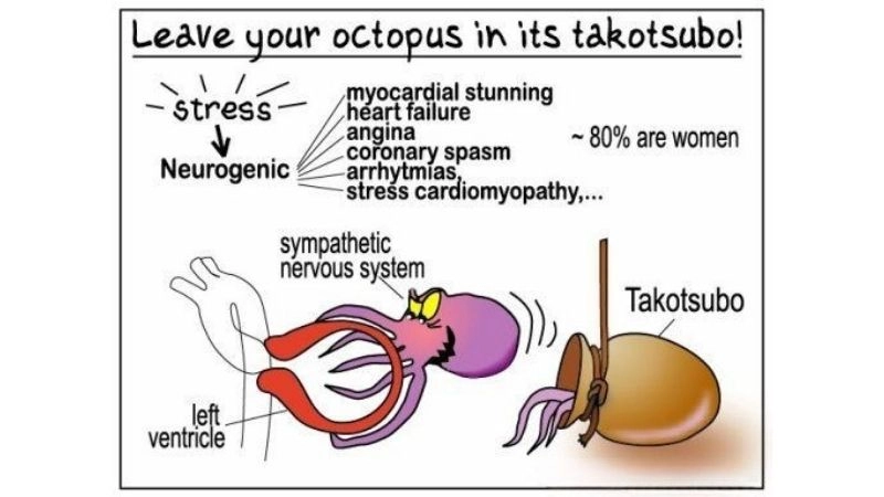 Broken heart syndrome recovery improving heart after shock