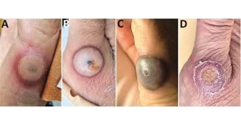 Tanapox is distinct from orthopoxvirus family