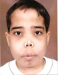 A diagram explaining what is thalassemia