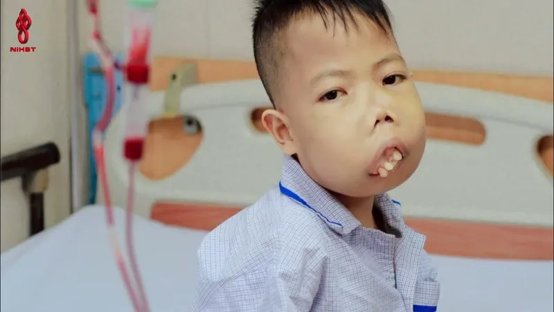 Microscopic view of cells in beta thalassemia