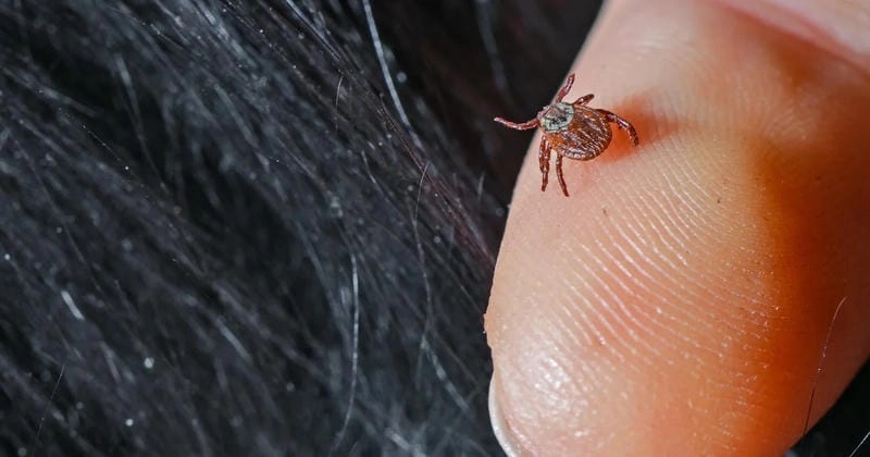 A clear image of a Rocky Mountain wood tick bite