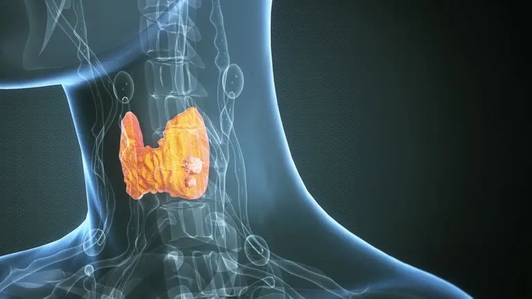 An infographic showing thyroid cancer symptoms