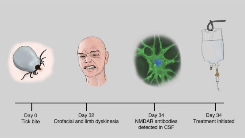 Important info about the TBE virus today