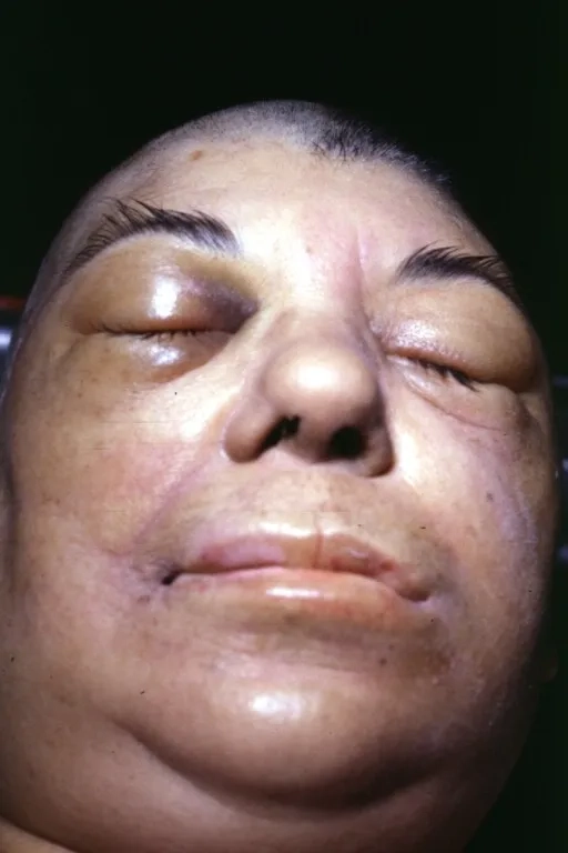 Visualizing the trichinosis life cycle