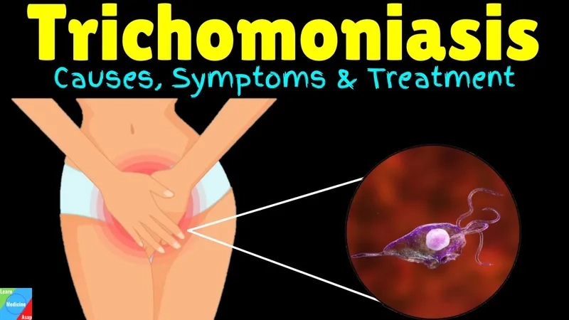 An infographic explaining what is trichomoniasis