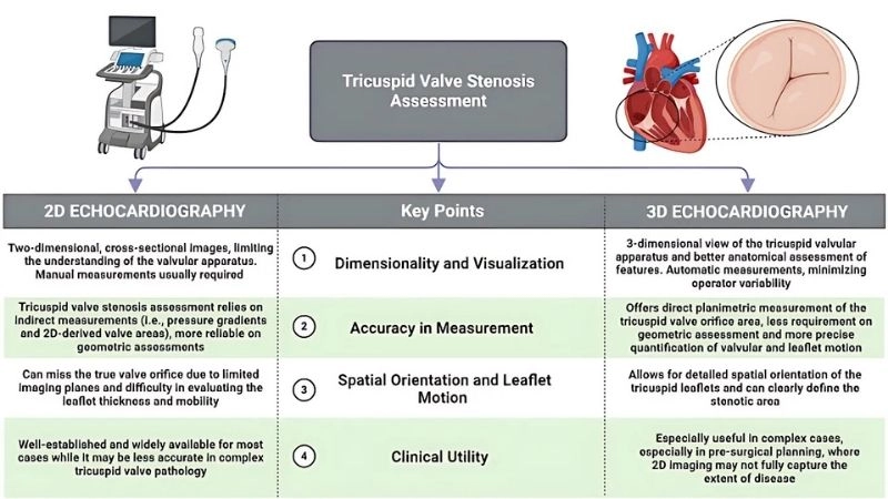 Tricuspid Stenosis Echo reveals narrowed valve opening
