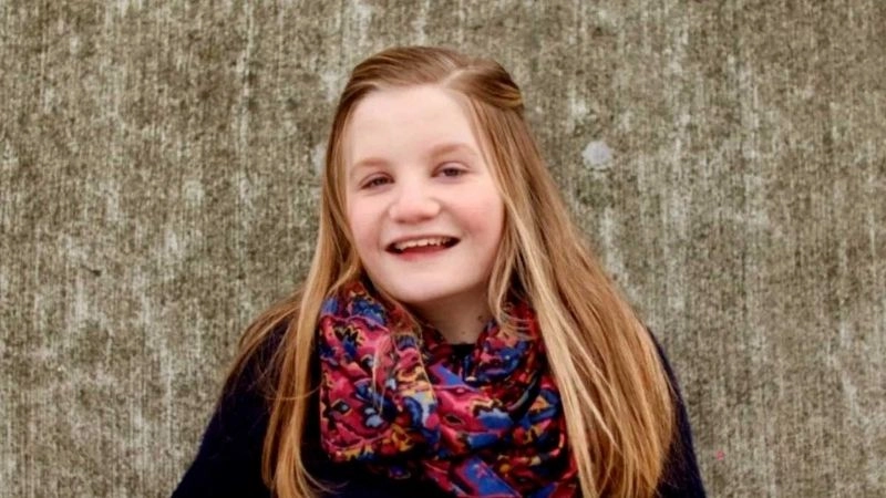 Aortic root dilation Turner syndrome monitoring