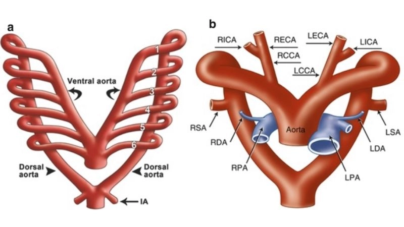 Vascular ring repair techniques outcomes and prognosis