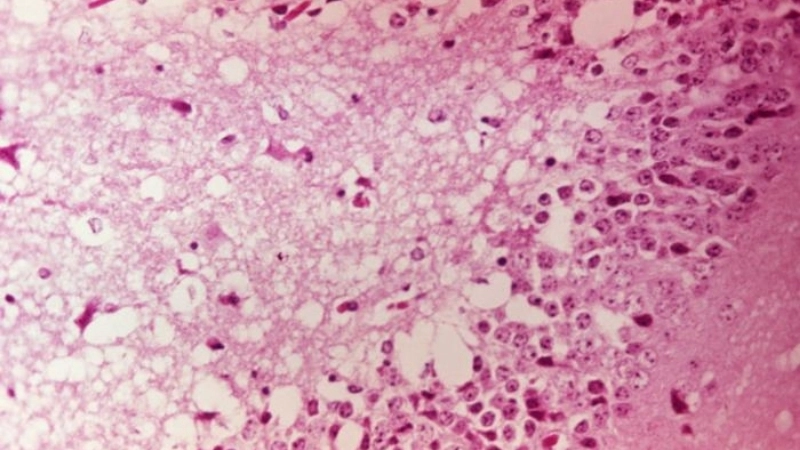 Venezuelan equine encephalitis virus spreads via mosquitoes fast