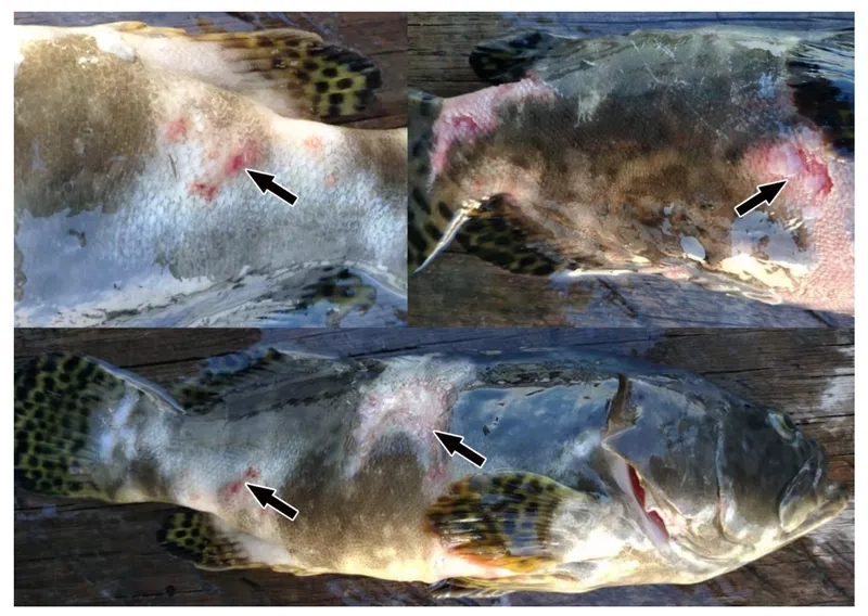 The danger of vibriosis from eating raw oysters