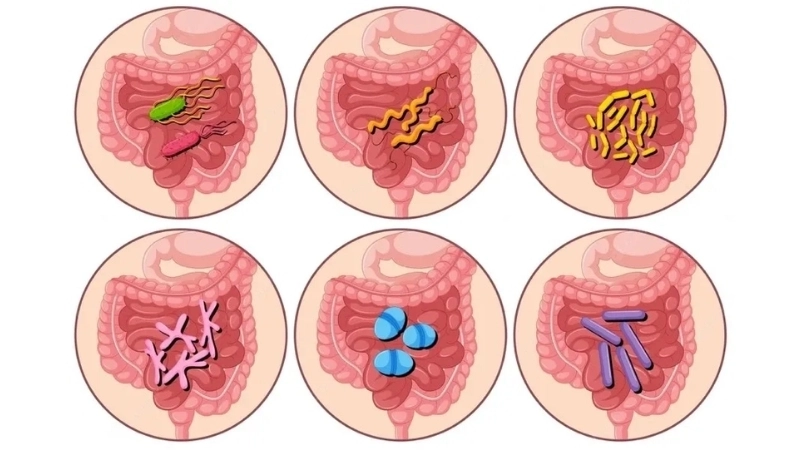 Viral Gastroenteritis causes stomach flu