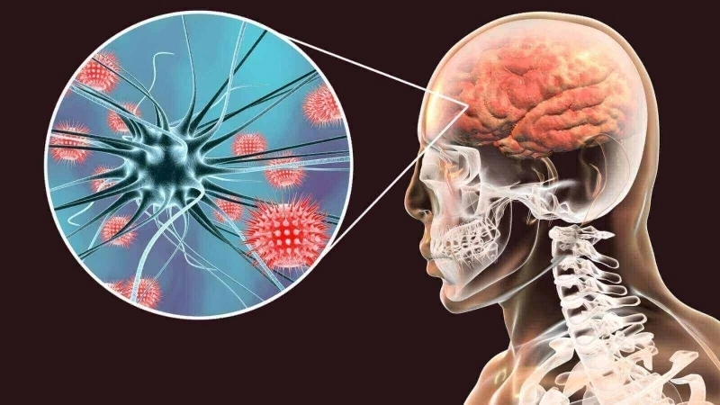 Recognize meningitis in babies signs early