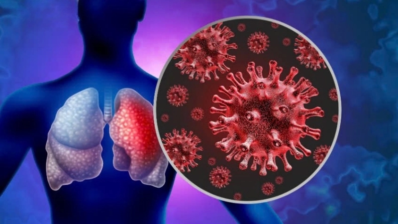 Discover effective ways for viral pneumonia treatment