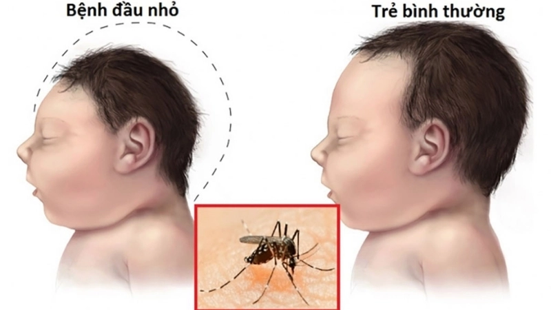 Diagram illustrating how is Zika transmitted