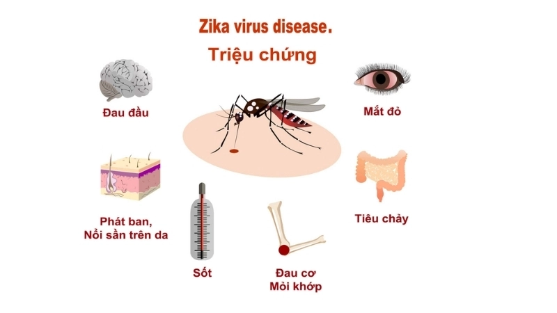 A chart comparing Zika vs Dengue symptoms